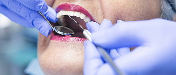 Best Knocked-Out Tooth (Avulsed Tooth) Treatment in Dallas Center, IA