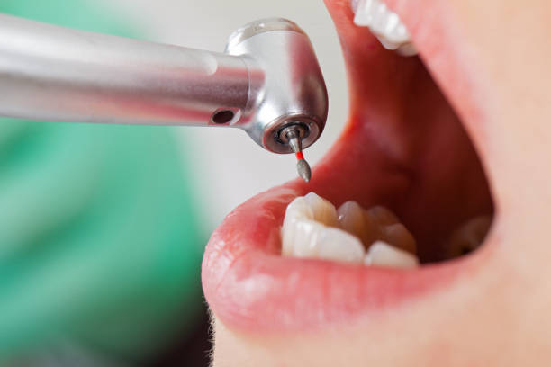 Professional Emergency Dental Service in IA